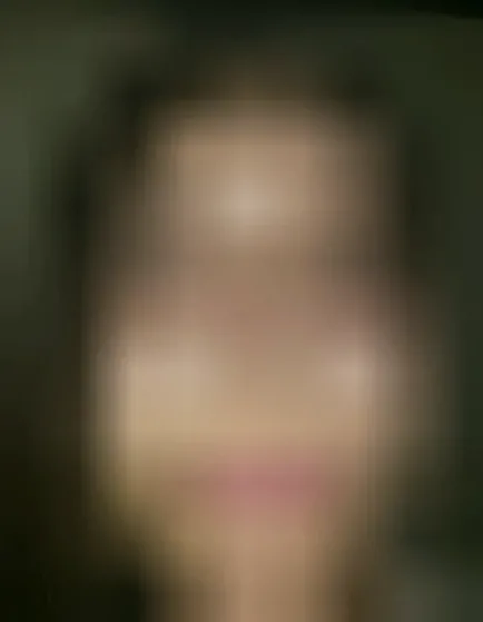 Merle, 20